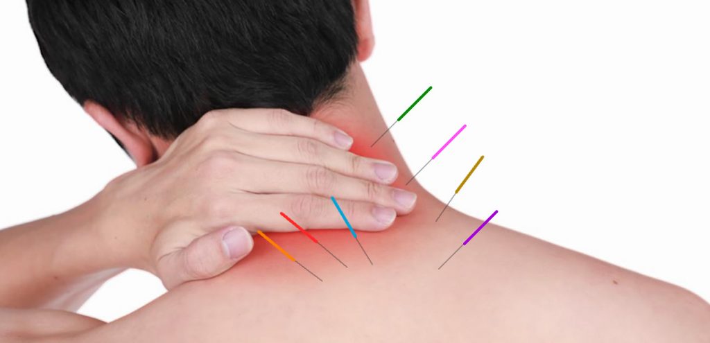 Vücut Ağrılarımızın Duygusal Sebepleri De Varmış Vücut Ağrılarımızın Duygusal Sebepleri De Varmış